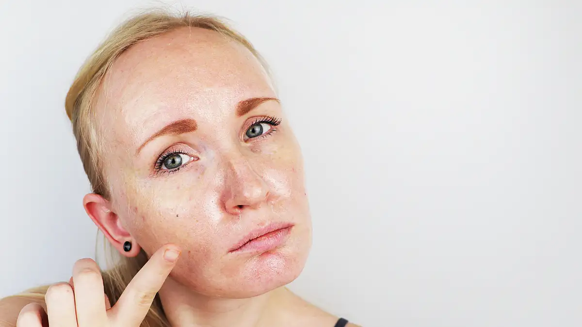 Produtos de skincare para pele oleosa